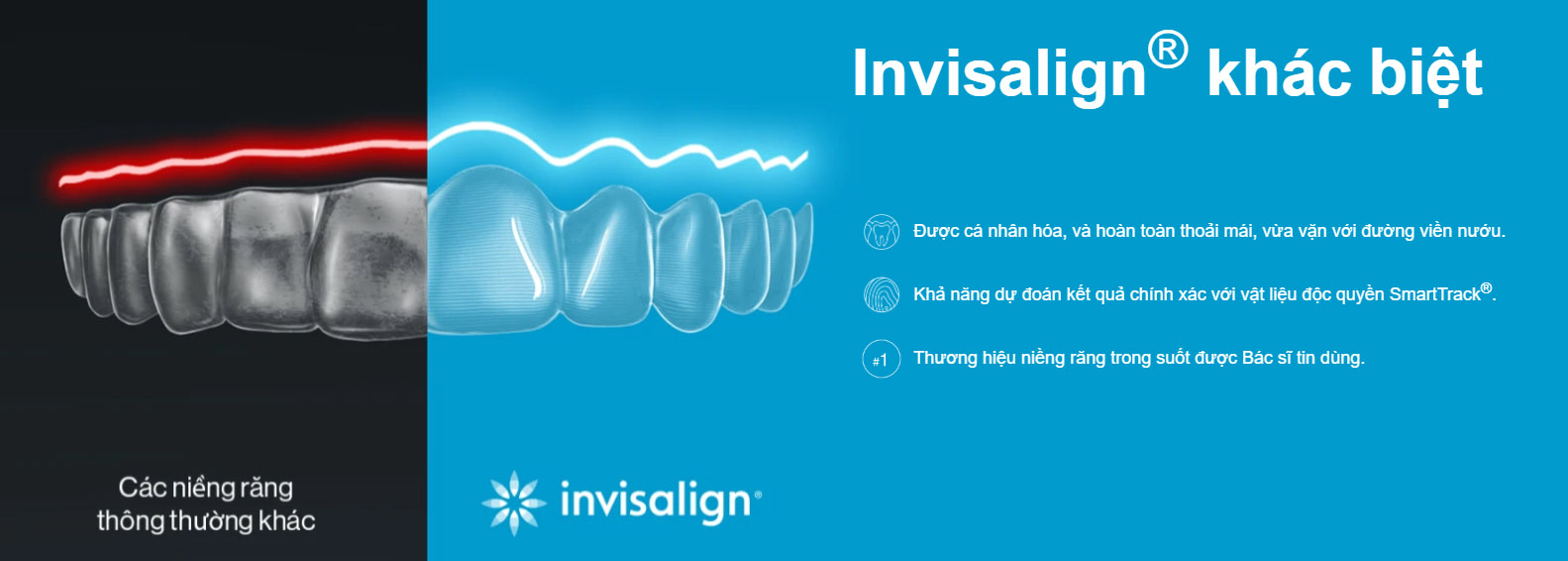 phương pháp niềng răng trong suốt invisalign tại nha khoa sun avenue.